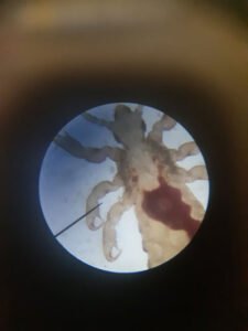 Louse under the microscope